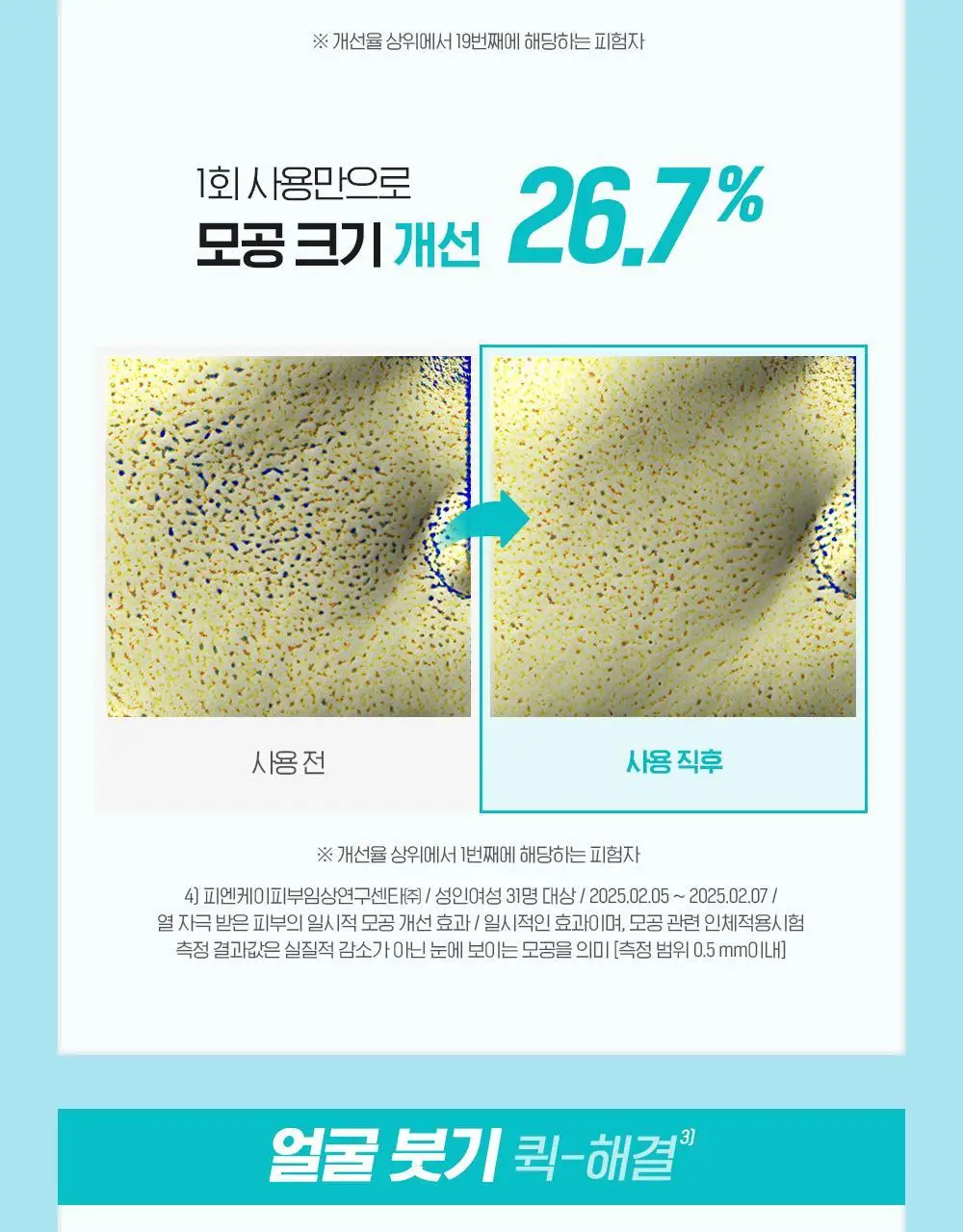 [화잘먹크림] 빌리프 아쿠아 밤 프로즌 크림 50ml 기획 (3종 중 택 1) 상세페이지 26